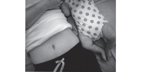 An Ode To A Postpartum Body